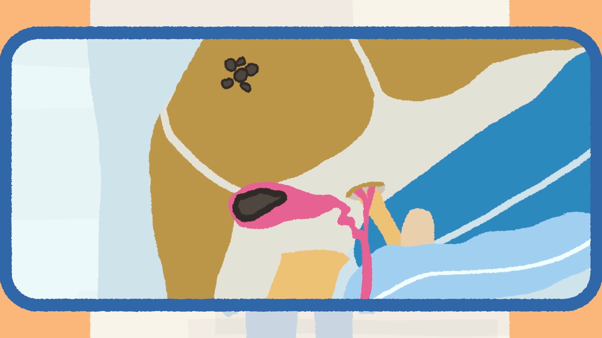 Ilustración: corte del cuerpo con la vesícula biliar, dentro de un marco azul.